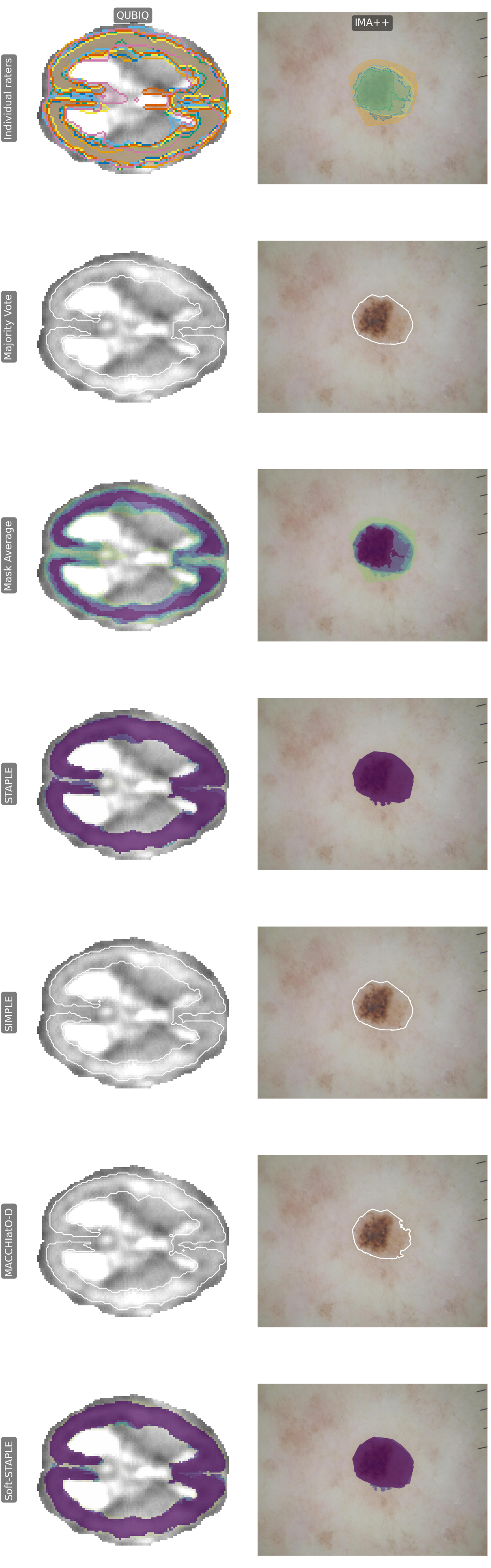 Individual raters and all methods on both cases
