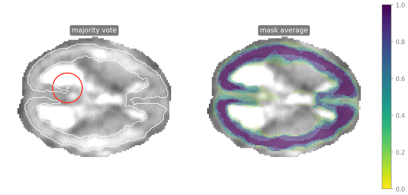 Majority vote and mask average on the QUBIQ case