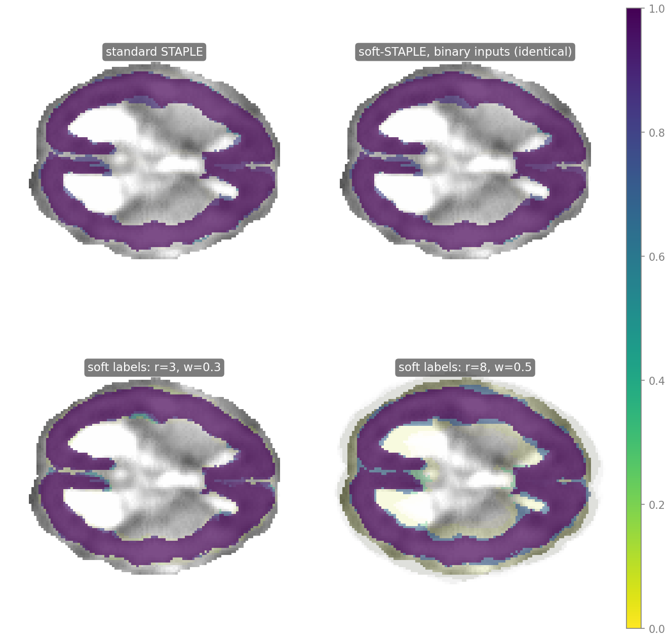 Standard STAPLE versus Soft-STAPLE at two soft-label settings